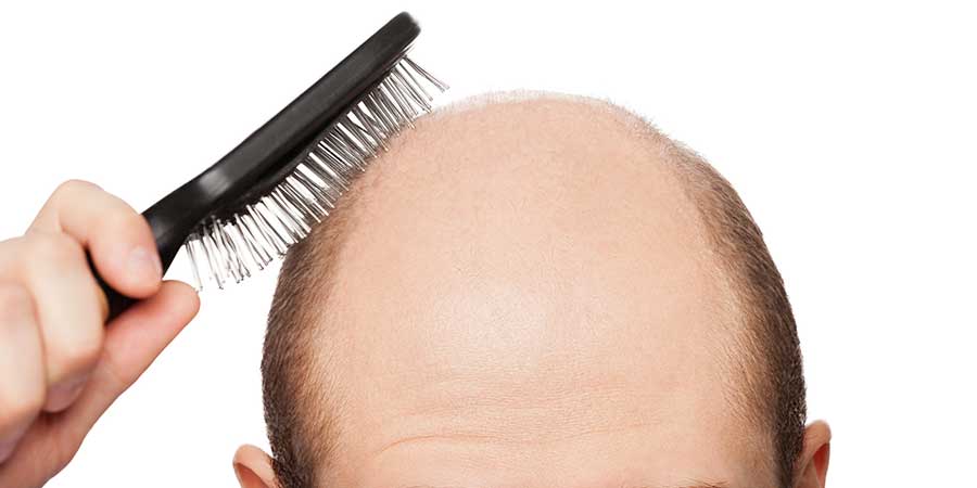 Suggerimenti per la crescita dei capelli di provata