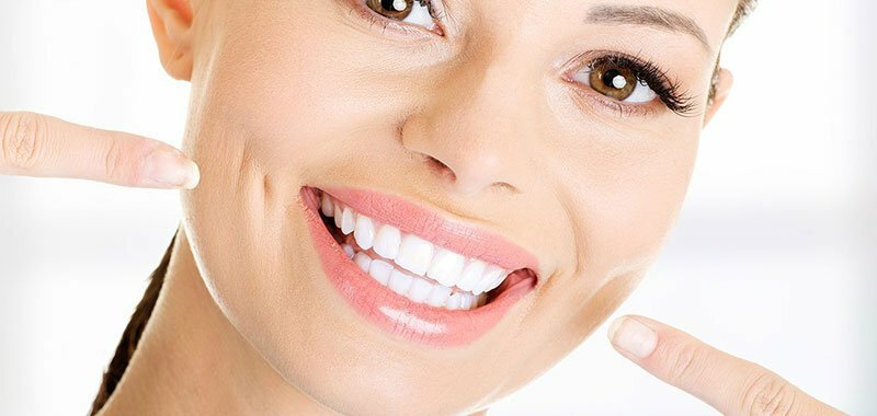 Dientes profesionales blanqueamiento