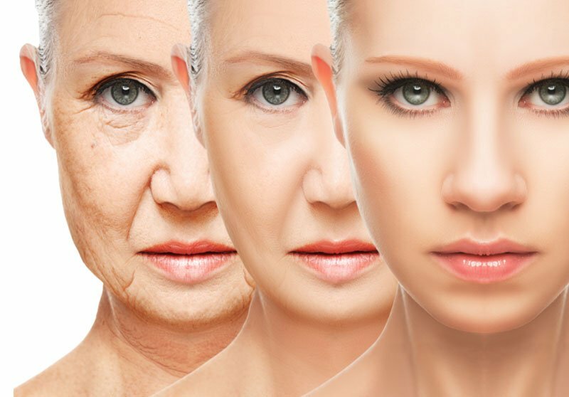 Botox, rellenos o cremas antiarrugas?