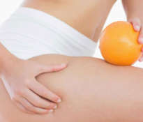 How to Reduce Cellulite