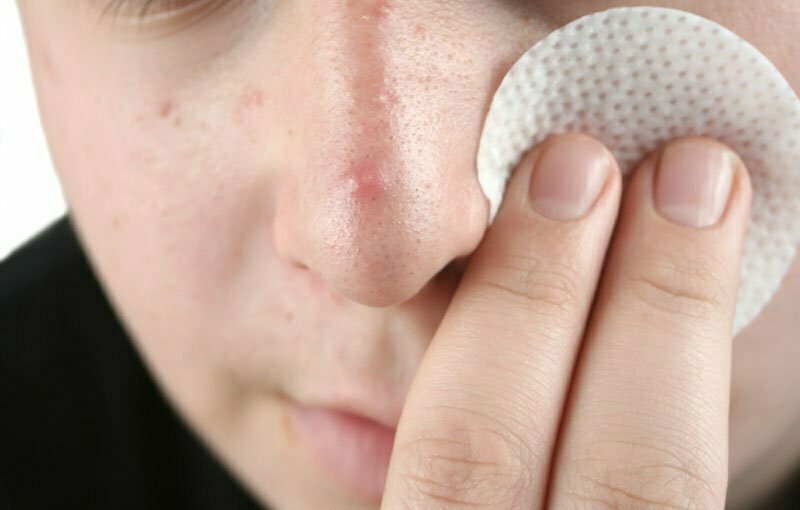 Bevist medicin til acne