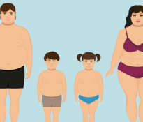 Obesity in children