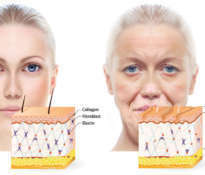 Nutrition of the skin that is aging