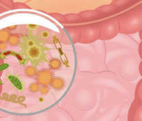 Intestinal microflora and effective slimming